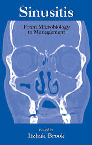 Sinusitis: From Microbiology To Management book cover