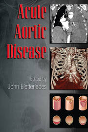Acute Aortic Disease book cover
