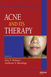 Acne and Its Therapy book cover