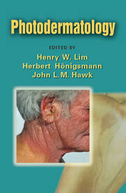 Photodermatology book cover