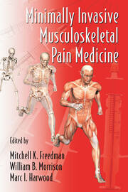 Minimally Invasive Musculoskeletal Pain Medicine book cover