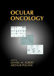 Ocular Oncology book cover