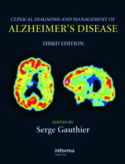 Clinical Diagnosis and Management of Alzheimer's Disease book cover