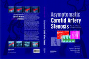 Asymptomatic Carotid Artery Stenosis: A Primer on Risk Stratification and Management book cover