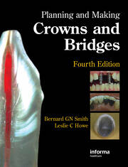Planning and Making Crowns and Bridges book cover
