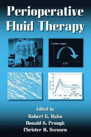 Perioperative Fluid Therapy book cover