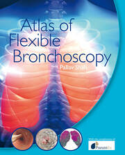 Atlas of Flexible Bronchoscopy book cover