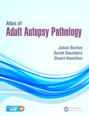Atlas of Adult Autopsy Pathology book cover