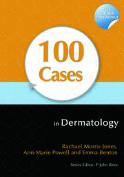 100 Cases in Dermatology book cover