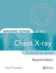 Making Sense of the Chest X-ray: A hands-on guide book cover