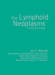 The Lymphoid Neoplasms 3ed book cover