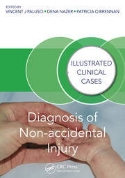 Diagnosis of Non-accidental Injury: Illustrated Clinical Cases book cover