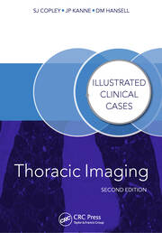 Thoracic Imaging: Illustrated Clinical Cases, Second Edition book cover