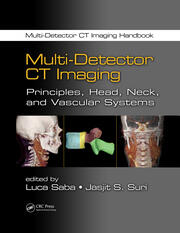 Multi-Detector CT Imaging: Principles, Head, Neck, and Vascular Systems book cover