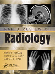 Rapid Review of Radiology book cover