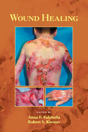 Wound Healing book cover