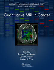 Quantitative MRI in Cancer book cover