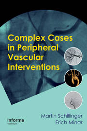 Complex Cases in Peripheral Vascular Interventions book cover