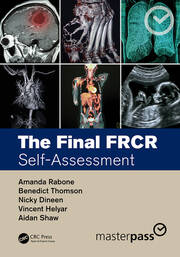 The Final FRCR: Self-Assessment book cover