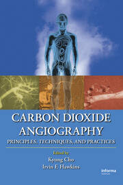 Carbon Dioxide Angiography: Principles, Techniques, and Practices book cover