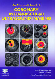 An Atlas and Manual of Coronary Intravascular Ultrasound Imaging book cover