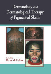 Dermatology and Dermatological Therapy of Pigmented Skins book cover