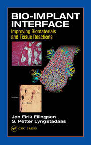 Bio-Implant Interface: Improving Biomaterials and Tissue Reactions book cover