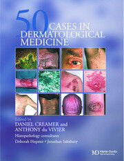 Fifty Dermatological Cases book cover