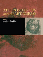 Atherosclerosis and Heart Disease book cover