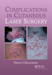 Complications in Laser Cutaneous Surgery book cover