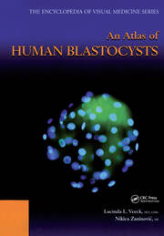 An Atlas of Human Blastocysts book cover