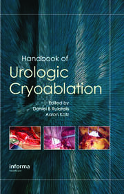Handbook of Urologic Cryoablation book cover