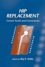 Hip Replacement: Current Trends and Controversies book cover