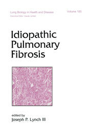 Idiopathic Pulmonary Fibrosis book cover