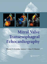 Mitral Valve Transesophageal Echocardiography book cover