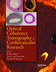 Optical Coherence Tomography in Cardiovascular Research book cover
