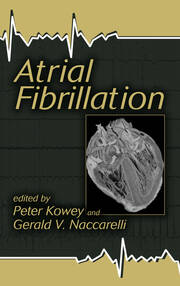 Atrial Fibrillation book cover