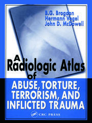A Radiologic Atlas of Abuse, Torture, Terrorism, and Inflicted Trauma book cover