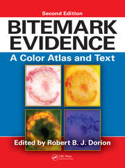 Bitemark Evidence: A Color Atlas and Text, 2nd Edition book cover