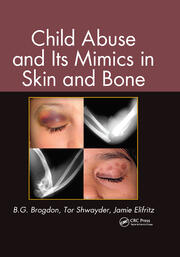 Child Abuse and its Mimics in Skin and Bone book cover