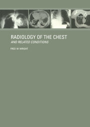 Radiology of the Chest and Related Conditions book cover