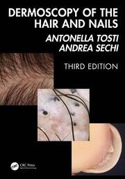 Dermoscopy of the Hair and Nails 3e book cover