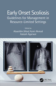 Early Onset Scoliosis: Guidelines for Management in Resource-Limited Settings book cover