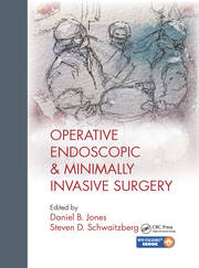 Operative Endoscopic and Minimally Invasive Surgery book cover