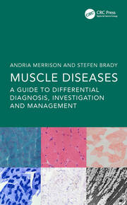 Muscle Diseases: A Guide to Differential Diagnosis, Investigation and Management book cover