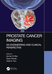 Prostate Cancer Imaging: An Engineering and Clinical Perspective book cover