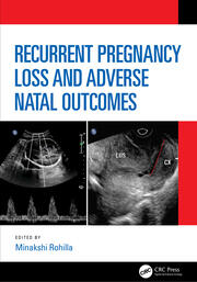 Recurrent Pregnancy Loss and Adverse Natal Outcomes book cover