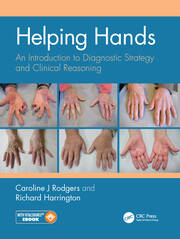 Helping Hands: An Introduction to Diagnostic Strategy and Clinical Reasoning book cover