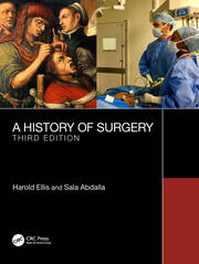 A History of Surgery: Third Edition book cover