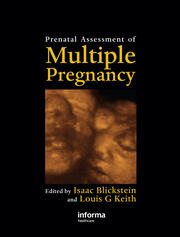 Prenatal Assessment of Multiple Pregnancy book cover